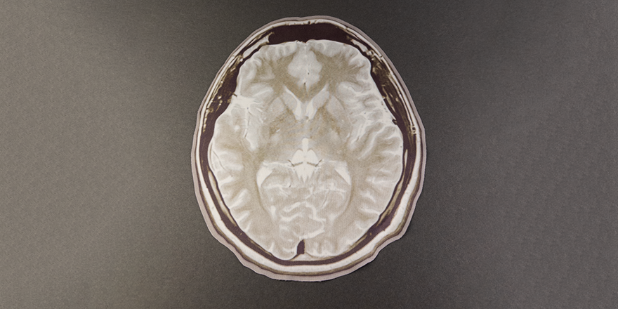 Brain MRI